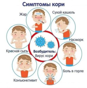 признаки Кори